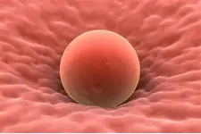 Mol Gebelik Belirtileri ve Tedavisi Mol Gebelik Belirtileri ve Tedavisi