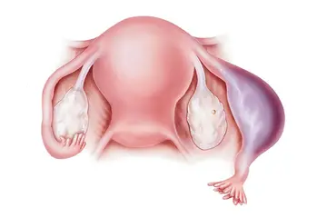 Dış Gebelik Belirtileri ve Tedavisi