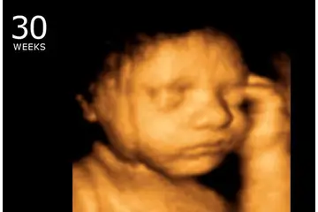 Gebelikte 30.hafta Beslenme ve Değerleri